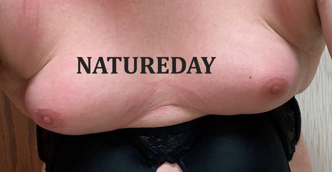 Breast implants and big nipples Bigger Nipples Archives Natureday Natural Products
